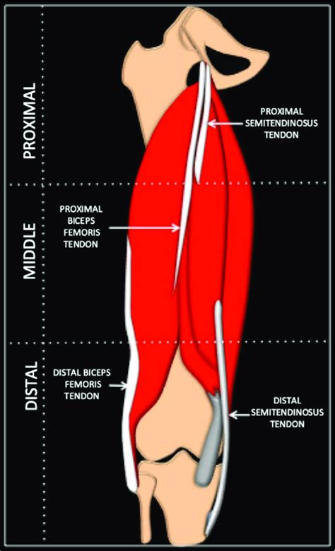 A Schematic Diagram Of The Left Hamstring Muscle Divided Into Proximal