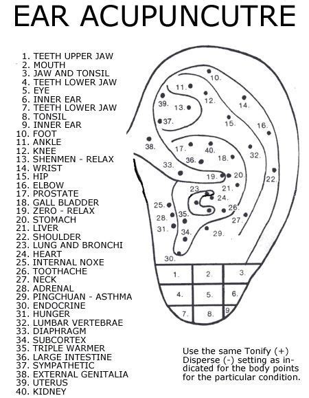 Ear Seeds Acupressure Points Chart