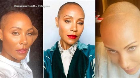 Video Jada Pinkett Smith Opens Up About Her Experience With Hair Loss Abc News