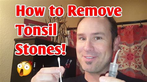 How To Remove Tonsil Stones Without Throwing Up Howtoermov