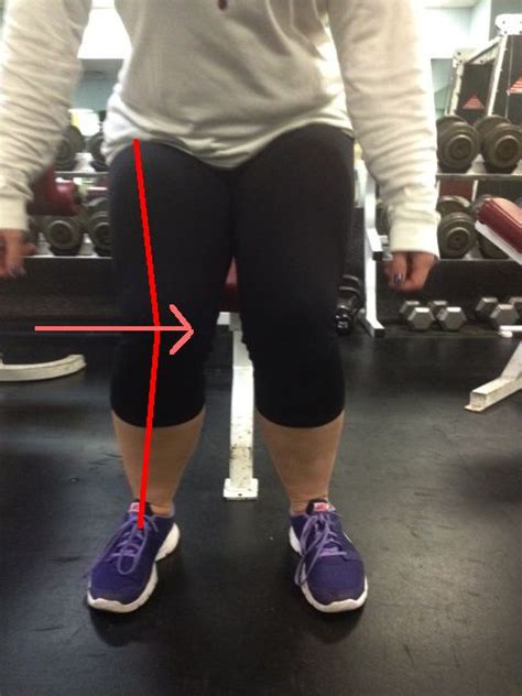 Squat Knees Caving In With Medial Displacement Lines Squats Sporty