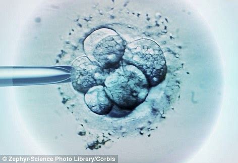Dozens Of IVF Babies Are Being Aborted Because They Have Down S