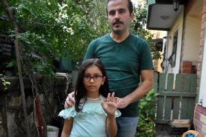 Gökoğlu, balığın şişme anını anbean görüntüledi. Balon balığı 8 yaşındaki çocuğun parmağının yarısını ...