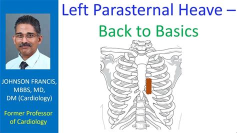 Left Parasternal Heave Back To Basics Youtube