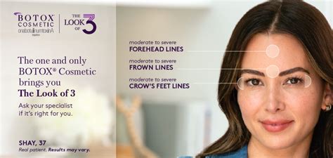 Botox Santa Rosa Injections By Dr Singh In Sonoma County