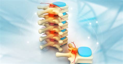 Understanding Minimally Invasive Spine Surgery Virella Spine Surgery