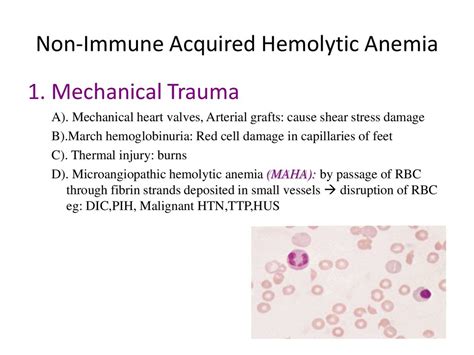 Get Non Immune Hemolytic Anemia Png