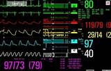 Images of Hospital Monitor Screen Explained