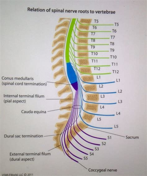 The 25+ best Cauda equina syndrome ideas on Pinterest | Cauda equina