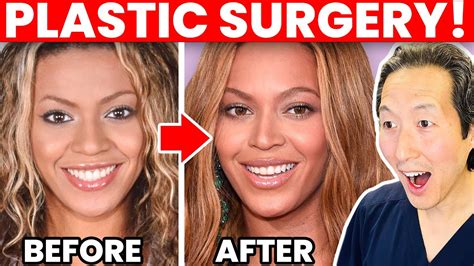 Beyonce Nose Then And Now