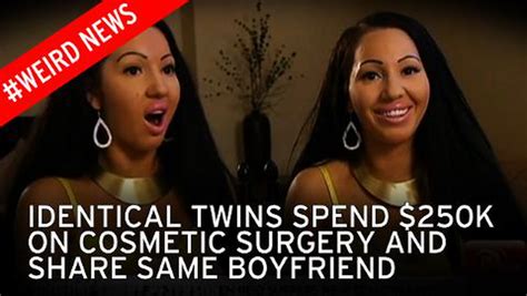 Worlds Most Identical Twins Spent £130k On Plastic Surgery And Even