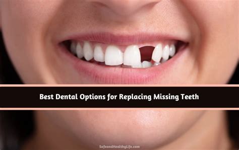 Best Dental Options For Replacing Missing Teeth