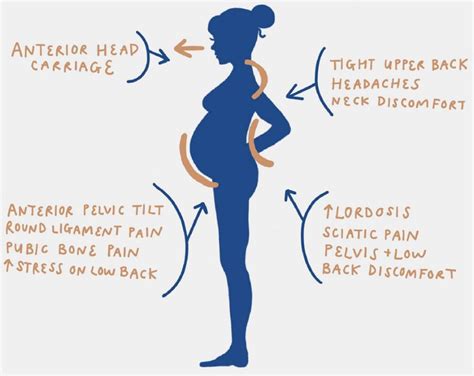 Low Back Pain Is It Common Or Normal During All 3 Trimesters Of Pregnancy Modern