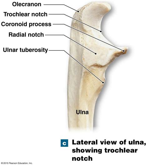 Laterial View Of Ulna Showing Trochlear Notch Medical Anatomy Human