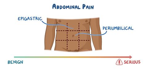 Approach To Periumbilical And Lower Abdominal Pain Clinical Sciences