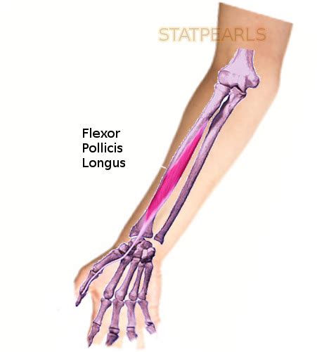 Figure Flexor Pollicis Longus Image Courtesy S Bhimji MD
