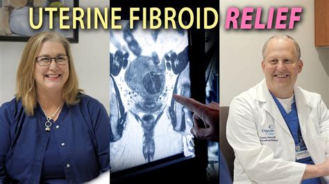 How Are Uterine Fibroids Treated Youtube