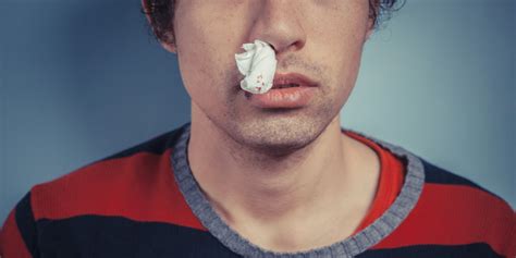 Strange Cause Of Mans Frequent Nosebleeds Discovered Huffpost