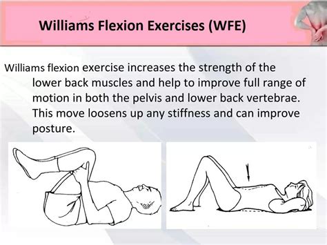 Williams Flexion Exercise Wfe For Treatment Of Low Back Pain