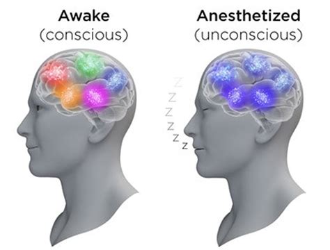 New Insights Into Activity Patterns Inside The Anesthetized Brain