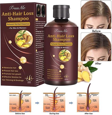Top Image Best Hair Thinning Shampoos Thptnganamst Edu Vn