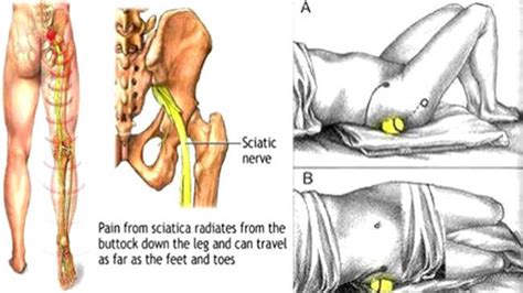 It is good to have a strong grip, not just for tennis and other sports, but also for your leisure activities such as cleaning if you have ever suffered from sciatica problems, you know how painful this condition feels. How to Use a Tennis Ball to Relieve Lower Back And ...