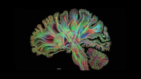 Self Reflected A First Look Brain Scan Brain Art Brain Science