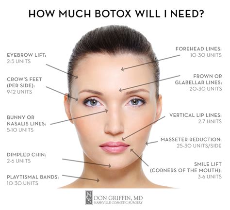 How much botox do i need? this is an important consideration before undergoing a botox treatment as the amount of botox (units) required determines the overall. Botox: Your First Visit - Nashville, Tennessee — Nashville ...