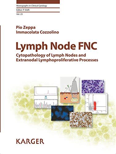 Lymph Node Fnc Cytopathology Of Lymph Nodes And Extranodal