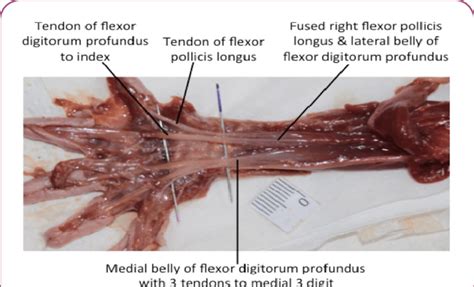 Both are made of collagen. Anterior view of the right forearm of female 33-week old ...