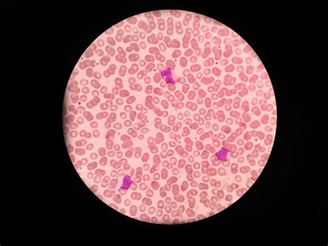 Monocyte And Lymphocyte Red Blood Cell Stock Image Image Of Clinical