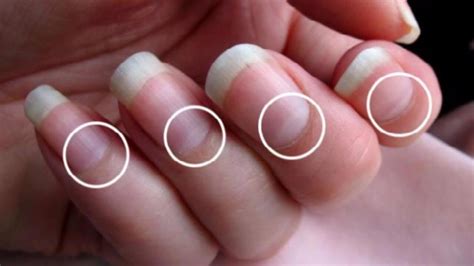 Fingernail Lunula What The Half Moons On Nails Reveal About Your
