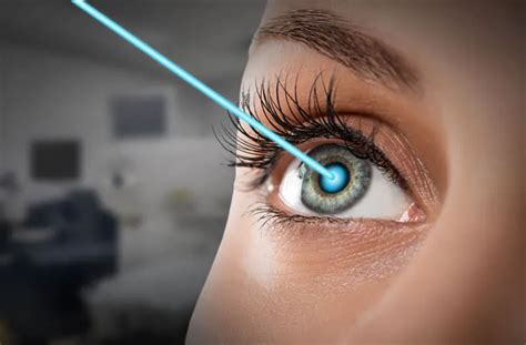 Laser Cataract Surgery And Procedure Bharti Eye Foundation