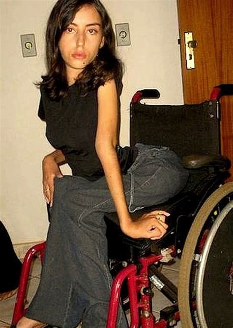 Spinal Muscular Atrophy Wheelchair Users Wheelchairs Amputee Quick