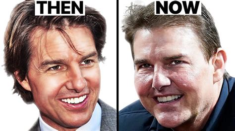Tom Cruise Why His Face Looks Different Plastic Surgery Analysis Cyber Clinic