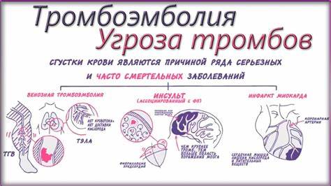 Тромбоэмболия - YouTube Картинка - Тромбоэмболия - YouTube