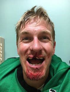 Online shop für eishockeyartikel, broomball & floorball. TERRY SAWCHUK DETROIT RED WINGS NO MASK FACE STiTCHES 8x10 ...