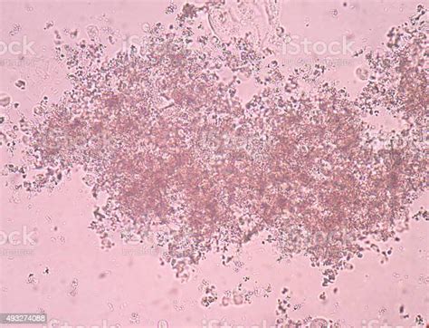 Amorf Dalam Sampel Urin Baikbaik Saja Dengan Mikroskop Foto Stok Unduh Gambar Sekarang Istock