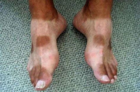 20 Shocking Tan Lines Youll Have To See To Believe