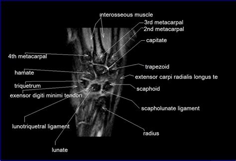 … this diagram with labels depicts and explains the. Wrist Tendons Anatomy - Anatomy Diagram Book