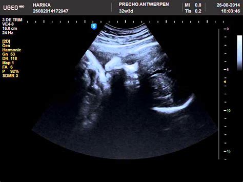 Fake Baby Ultrasound With Name Ababyw