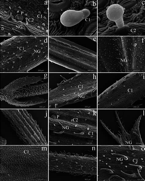 Basil is used for stomach spasms, loss of appetite, intestinal gas, kidney conditions, fluid retention, head colds, warts, and worm infections. SEM micrographs with different types of trichomes on M ...