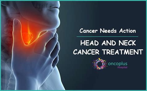 What Does Head And Neck Cancer Feel Like Head Neck Cancers Signs