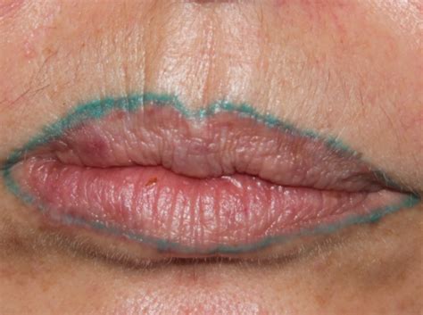 Dermatologist issues cosmetic tattoo warning ...