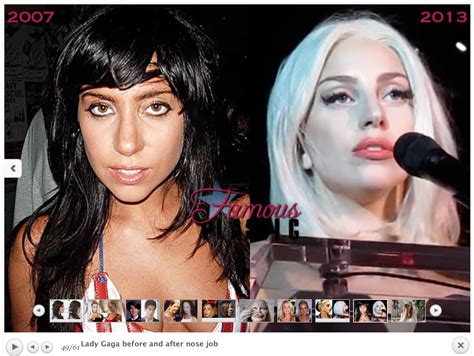 Lady Gaga Lady Gaga Nose Nose Job Lady Gaga Plastic Surgery