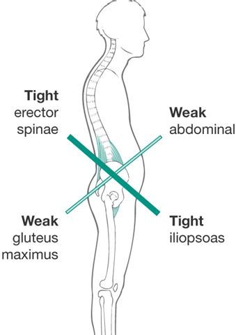 They may genuinely have tight muscles in the hips that need stretching, but they may also need to strengthen the hip flexors or related to really focus on one area at a time, try a single leg skating squat. Do Tight Hip Flexors Correlate to Glute Weakness?