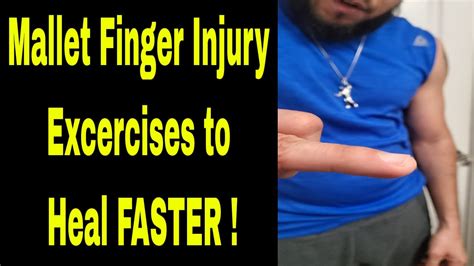 Mallet Finger Injury Exercises Tips Treatment Heal Faster Youtube