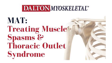 Vestibular anatomy and neurophysiology online course: Treating Subclavius Muscle Spasm for Thoracic Outlet ...