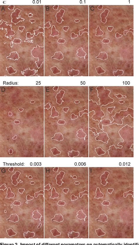 Figure 2 From Automated Detection Of Actinic Keratoses In Clinical