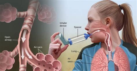 How To Control Breathing During Asthma Attack Know Your Asthma